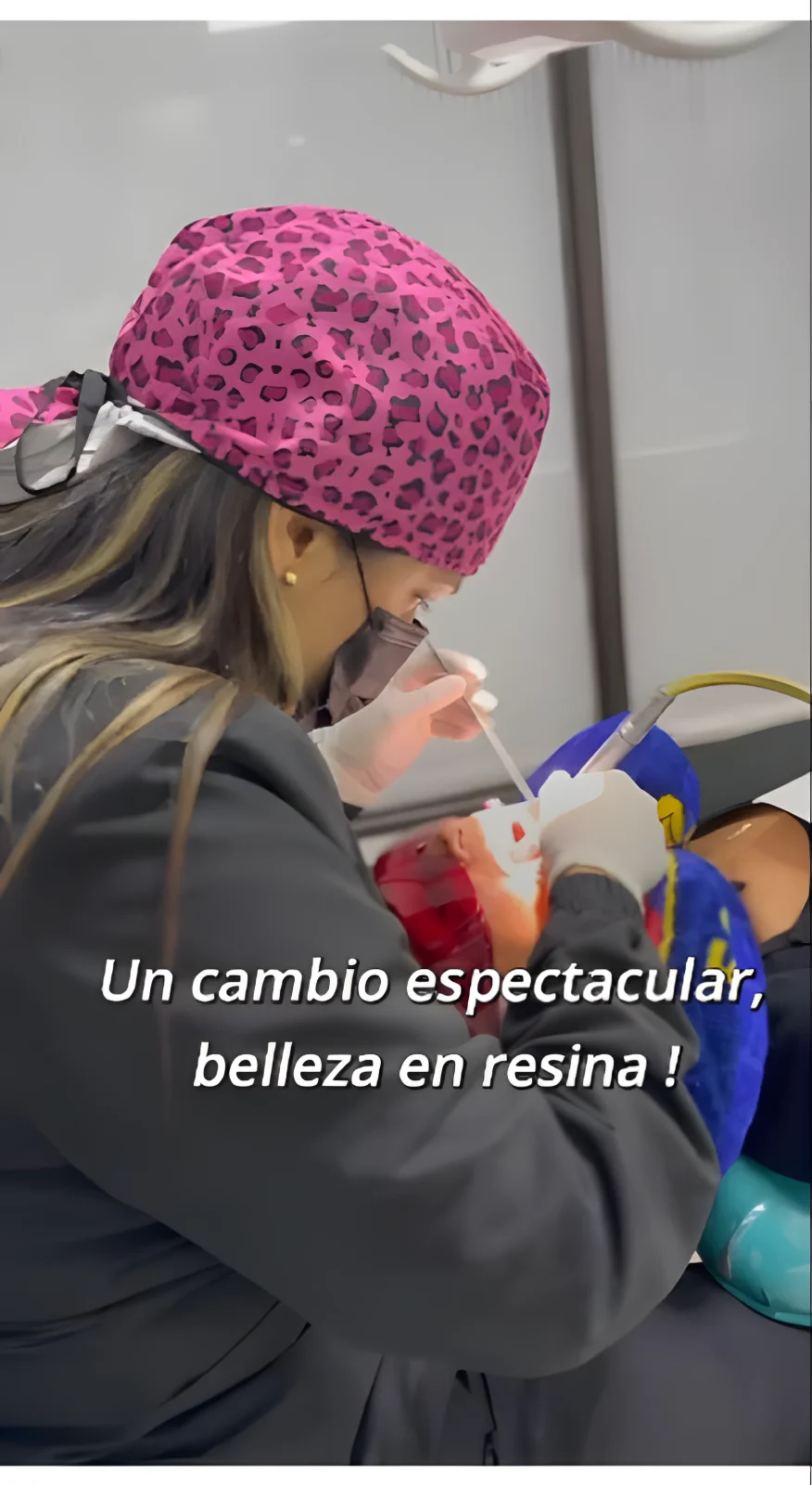 Tratamiento estético dental en el consultorio
